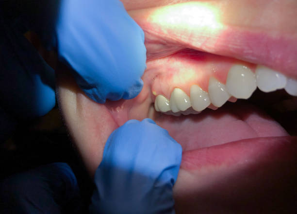 Best Urgent Tooth Repair  in Ddanelle, AR