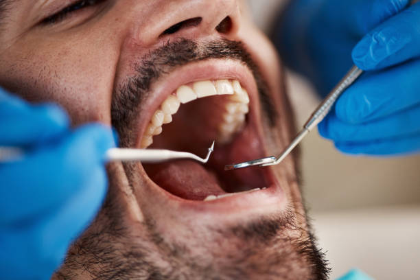 Best Emergency Dental Filling Replacement  in Ddanelle, AR