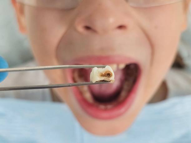 Best Affordable Emergency Dental Care  in Ddanelle, AR