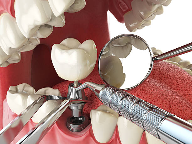 Best Cracked Tooth Emergency Dentist  in Ddanelle, AR